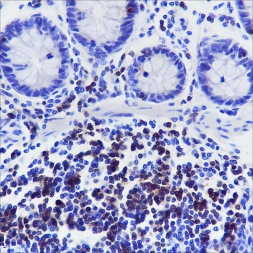 Recombinant CD3G Monoclonal Antibody - small - 3