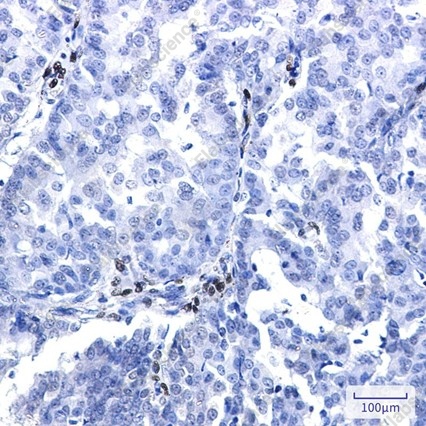 Recombinant NR2F2 Monoclonal Antibody - 3