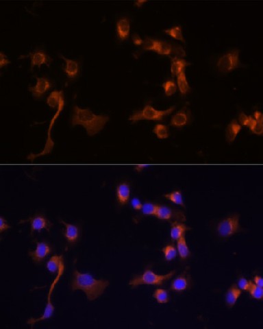Immunofluorescence analysis of A431 cells using ABL1 Polyclonal Antibody at dilution of 1:100 (40x lens). Blue: DAPI for nuclear staining.