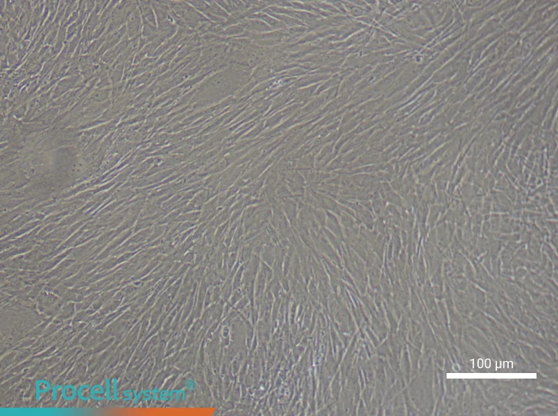 Human Cerebral Artery Smooth Muscle Cell Complete Medium - 3