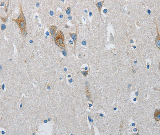 Immunohistochemistry of paraffin-embedded Human brain  using ATG4A Polyclonal Antibody at dilution of 1:30