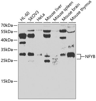 Western blot analysis of extracts of various cell lines using NFYB Polyclonal Antibody at 1:500 dilution.