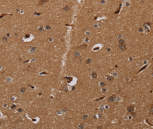 Immunohistochemistry of paraffin-embedded Human brain using MOB1A Polyclonal Antibody at dilution of 1:30