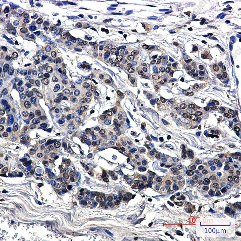 Recombinant MARS Monoclonal Antibody - 3