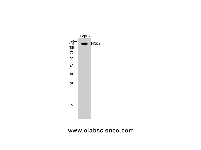 Western Blot analysis of HepG2 cells with NOS3 Polyclonal Antibody.