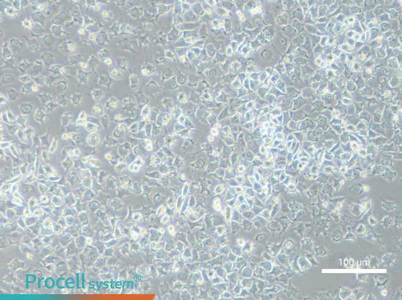 92-1 [Human uveal melanoma] - 1