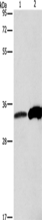 Western Blot analysis of Raw264.7 cell and Human fetal liver tissue using ANXA4 Polyclonal Antibody at dilution of 1:500