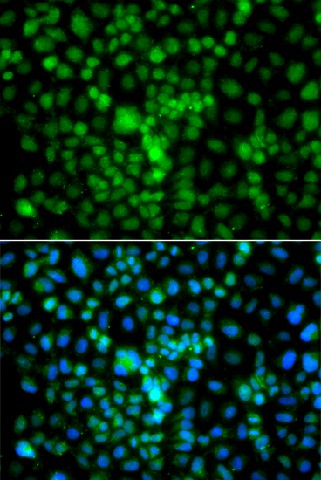 Immunofluorescence analysis of A549 cells using CIDEA Polyclonal Antibody