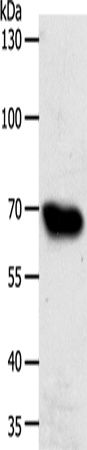 Western Blot analysis of HT-29 cell using ABCG1 Polyclonal Antibody at dilution of 1:500