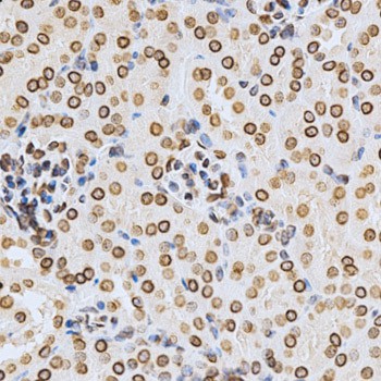 Immunohistochemistry of paraffin-embedded Mouse kidney using Lamin A/C Polyclonal Antibody at dilution of  1:200 (40x lens).