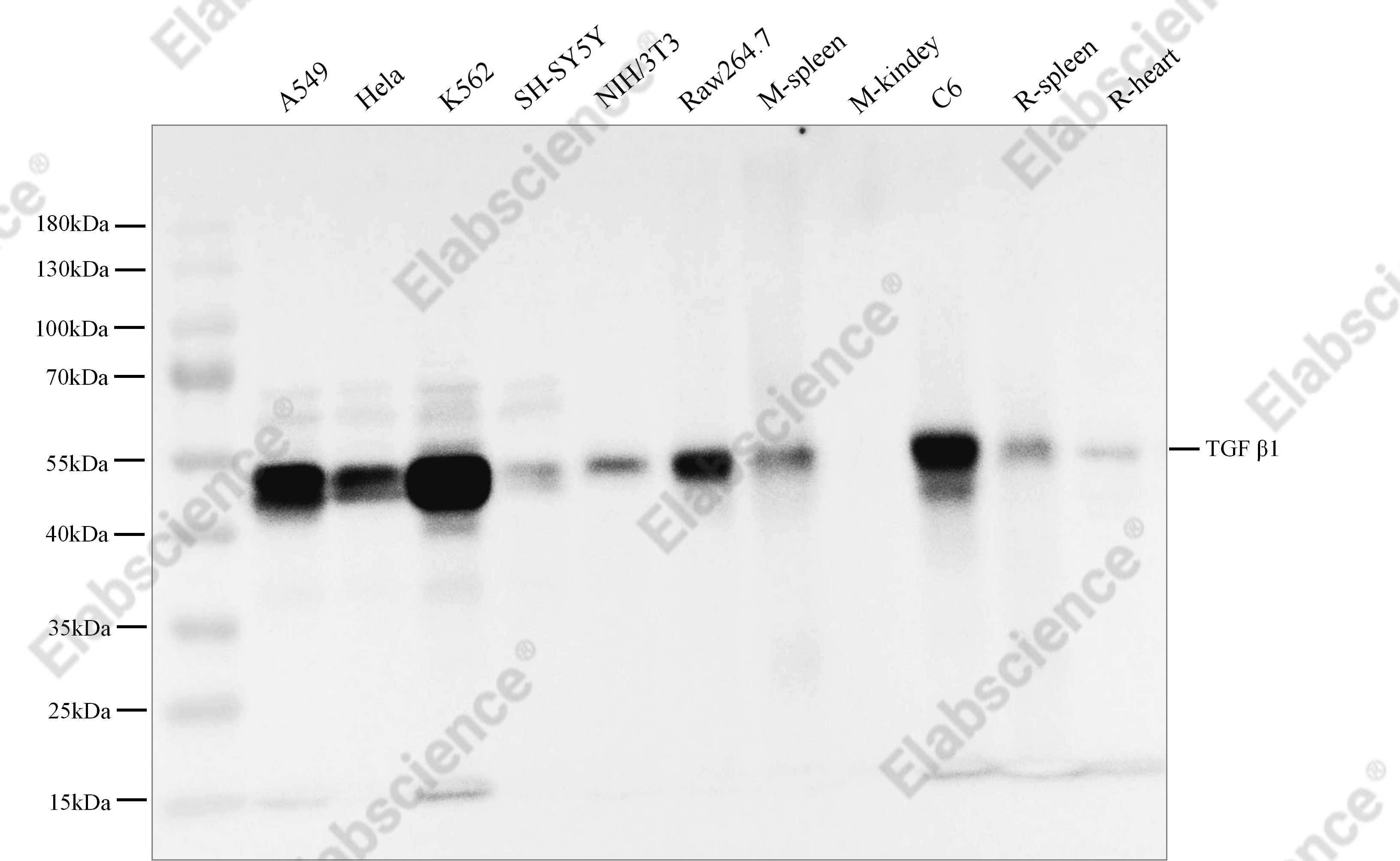 Recombinant TGF β1 Monoclonal Antibody - 1