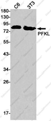 Recombinant PFKL Monoclonal Antibody - 1