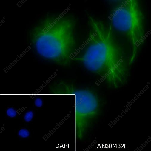 Recombinant ALOX15 Monoclonal Antibody - 4