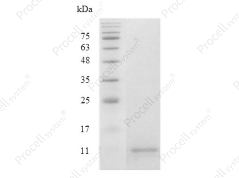 CCL4/MIP-1&beta;/ACT-2, Human, Recombinant