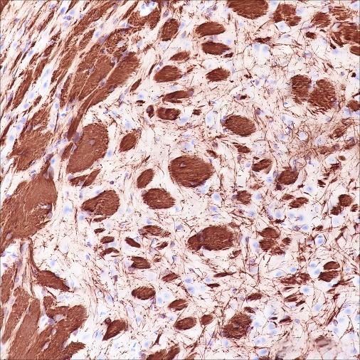 Recombinant MAG Monoclonal Antibody - small - 6