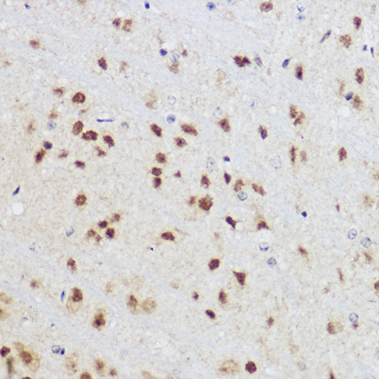 Immunohistochemistry of paraffin-embedded mouse brain using KLF12 Polyclonal Antibody at dilution of 1:100 (40x lens).Perform high pressure antigen retrieval with 10 mM citrate buffer pH 6.0 before commencing with IHC staining protocol.