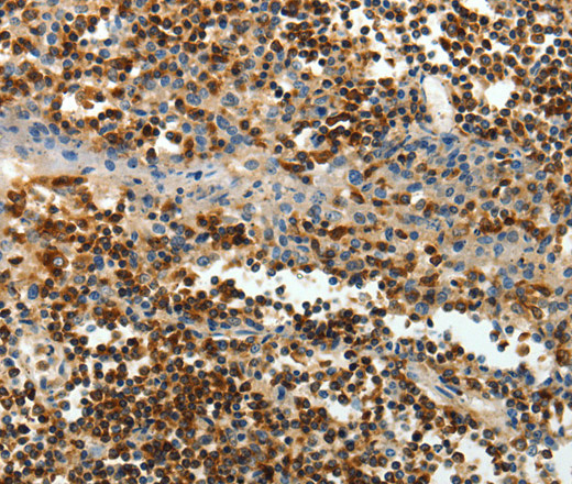 Immunohistochemistry of paraffin-embedded Human tonsil tissue using AMD1 Polyclonal Antibody at dilution 1:40