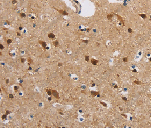 IL19 Polyclonal Antibody - 3