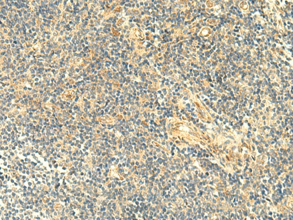 Immunohistochemistry of paraffin-embedded Human tonsil tissue  using ASB6 Polyclonal Antibody at dilution of 1:50(?200)