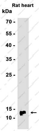 Recombinant Cytochrome C Oxidase subunit Vic Monoclonal Antibody - 2