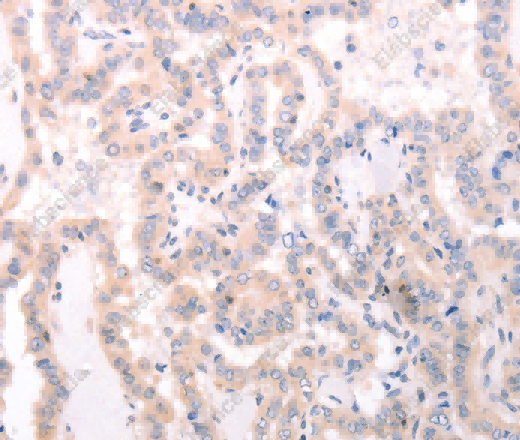 TRAF3IP1 Polyclonal Antibody - 2