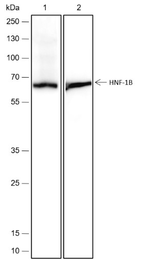 Recombinant HNF-1B Monoclonal Antibody - small - 2