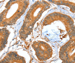 ACOT11 Polyclonal Antibody - 3