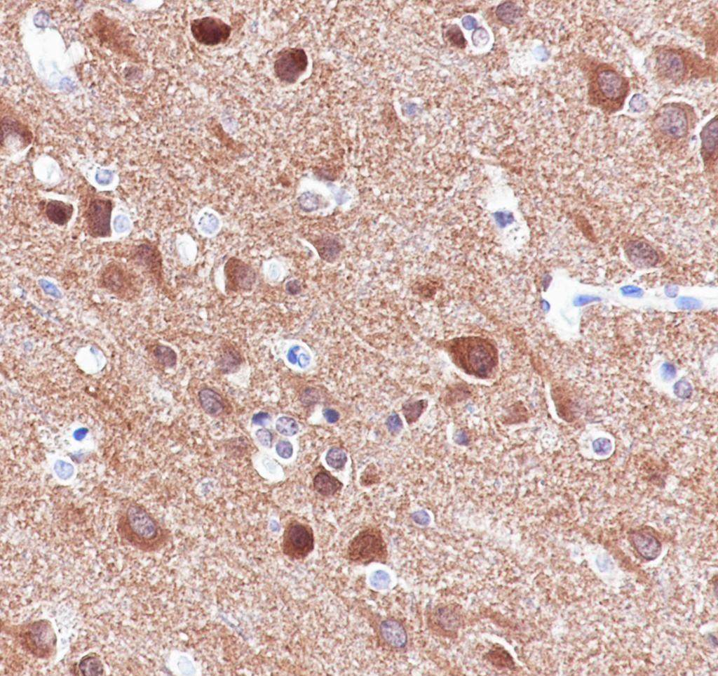 Recombinant DNAJC6 Monoclonal Antibody - 3