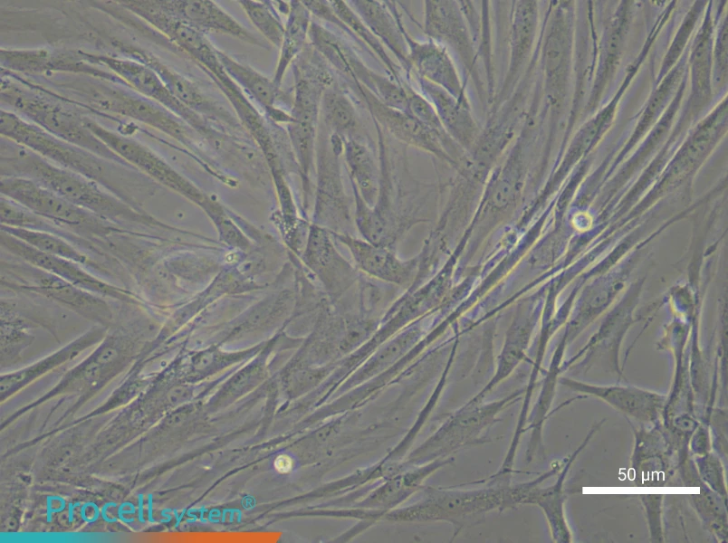 Human Tracheal Fibroblast Complete Medium - 6