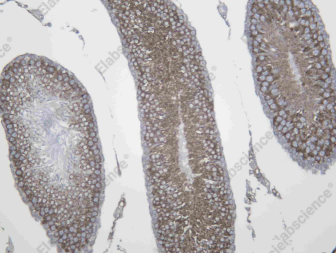 Recombinant SHLB1 Monoclonal Antibody - 3