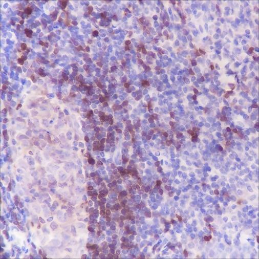 Recombinant TCL1 Monoclonal Antibody - small - 3