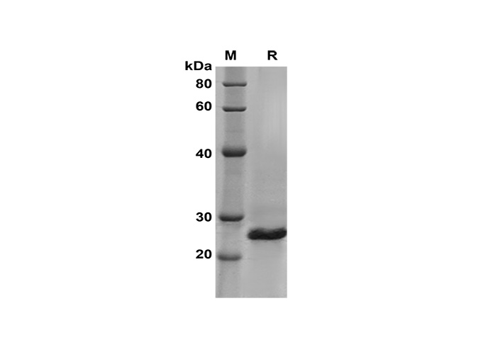 Recombinant Human CD80 Protein(Fc Tag)-产品推荐-1