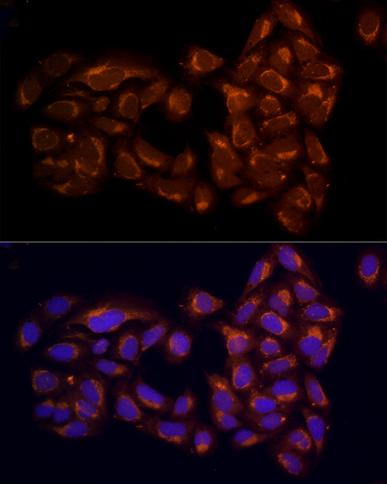 Immunofluorescence analysis of U2OS cells using RPH3AL Polyclonal antibody at dilution of 100 (40x lens). Blue: DAPI for nuclear staining.
