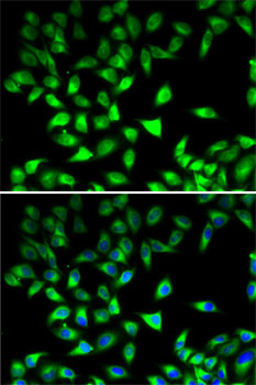 Immunofluorescence analysis of MCF7 cells using STAT4 Polyclonal Antibody