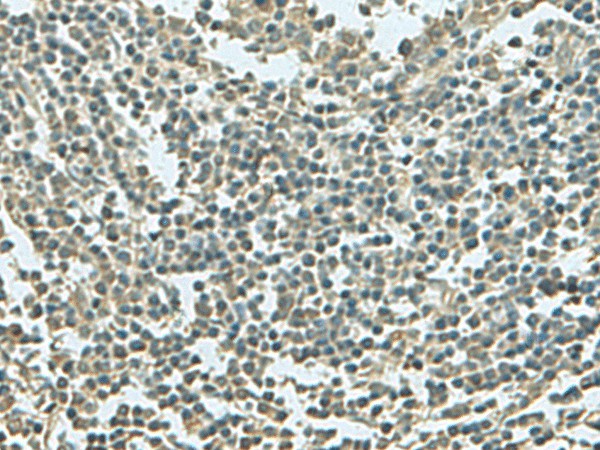 Immunohistochemistry of paraffin-embedded Human tonsil tissue  using KRT36 Polyclonal Antibody at dilution of 1:55(?200)