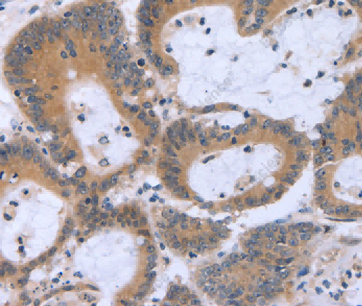 ECE1 Polyclonal Antibody - 3