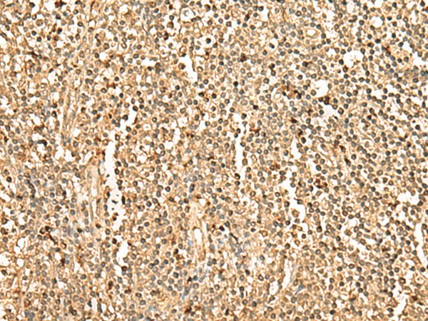 Immunohistochemistry of paraffin-embedded Human tonsil tissue  using PPM1G Polyclonal Antibody at dilution of 1:35(?200)