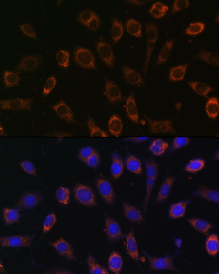 Immunofluorescence analysis of L929 cells using TCIRG1 Polyclonal Antibody at dilution of  1:100 (40x lens). Blue: DAPI for nuclear staining.