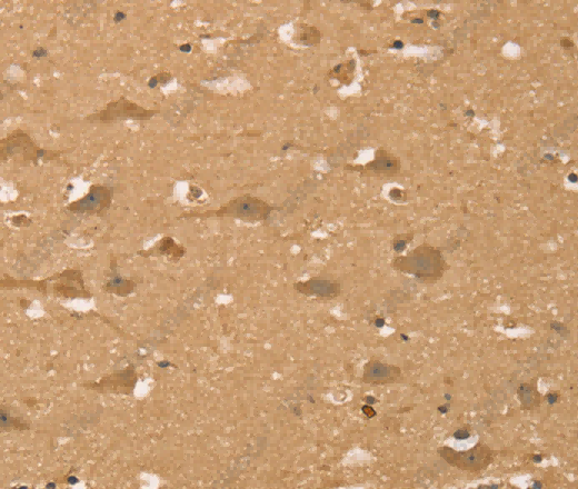 HIF1AN Polyclonal Antibody - 3