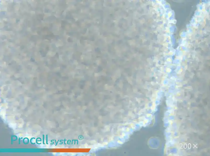 HH [Human lymphoma] Cell Complete Medium - 4