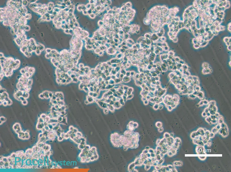 HCC1187 - 4