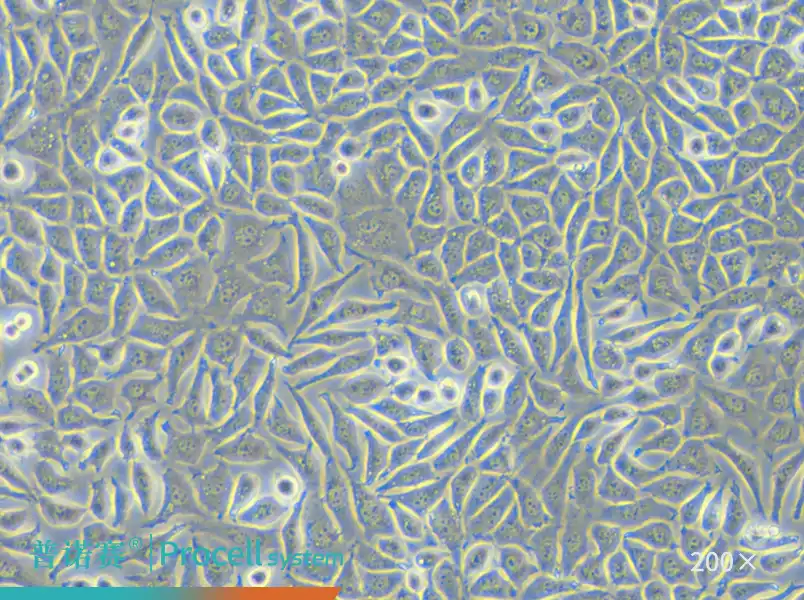 NCTC clone 929 [L cell, L-929]（小鼠成纤维细胞）-细胞系-武汉普诺赛生命科技有限公司