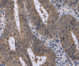 CDK5 Polyclonal Antibody - 2