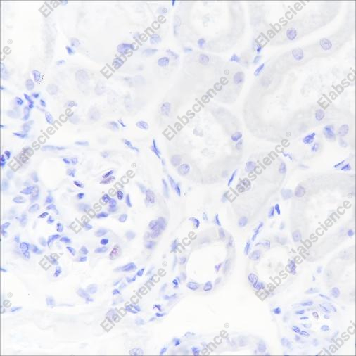 Recombinant hCG beta Monoclonal Antibody - 2