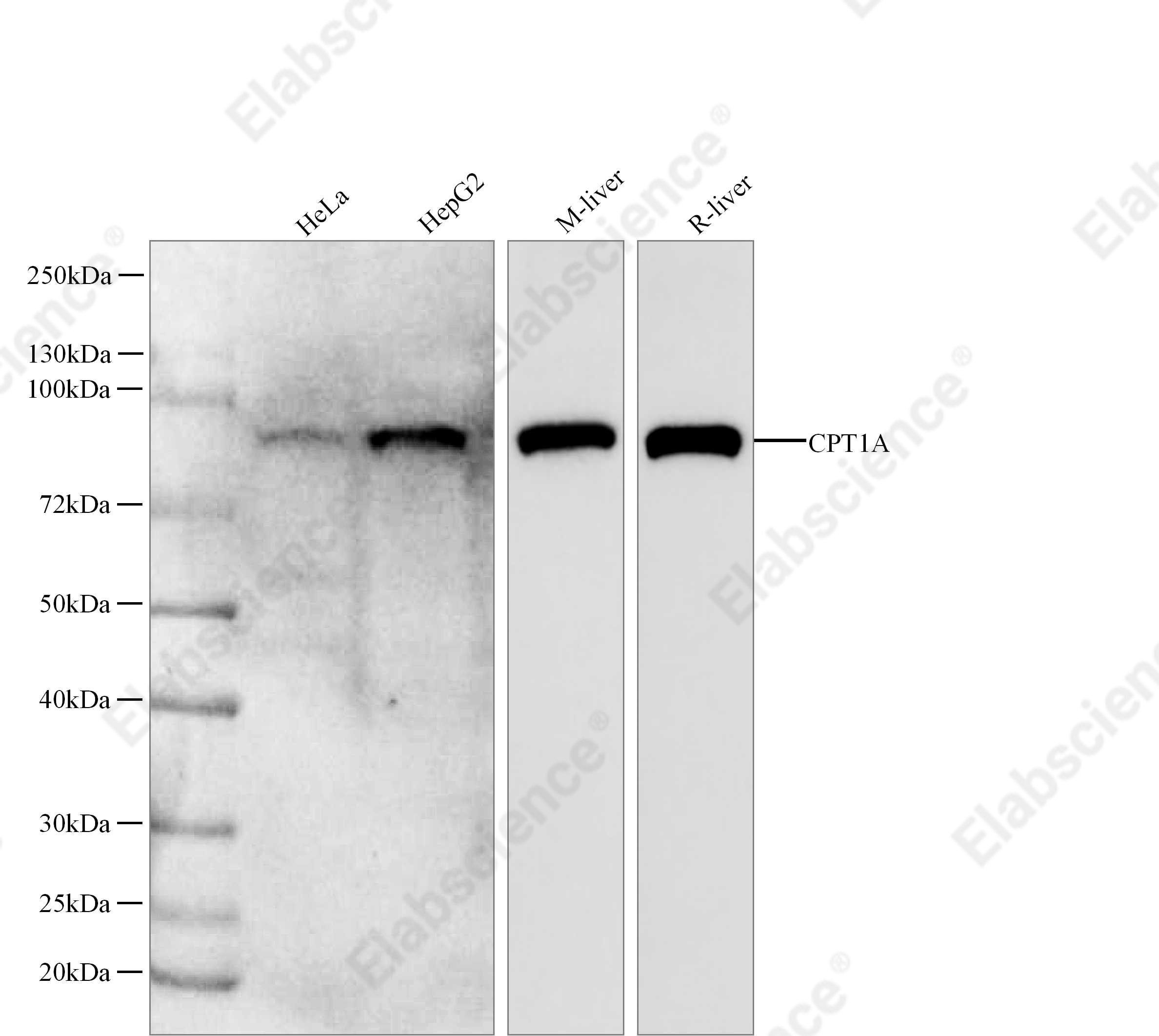Recombinant CPT1A Monoclonal Antibody - 1