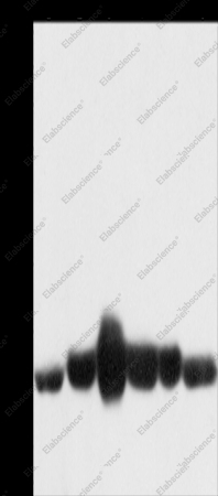 CAV1 Polyclonal Antibody - 1
