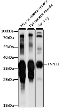 Western blot analysis of extracts of various cell lines using TNNT3 Polyclonal Antibody at 1:1000 dilution.