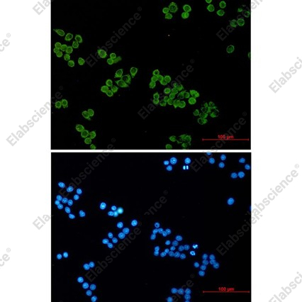 Recombinant SNAP25 Monoclonal Antibody - 3
