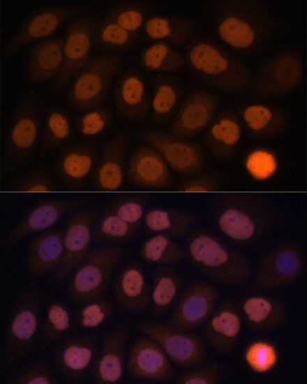 Immunofluorescence analysis of HeLa cells using KLF6 Polyclonal Antibody at dilution of  1:100. Blue: DAPI for nuclear staining.