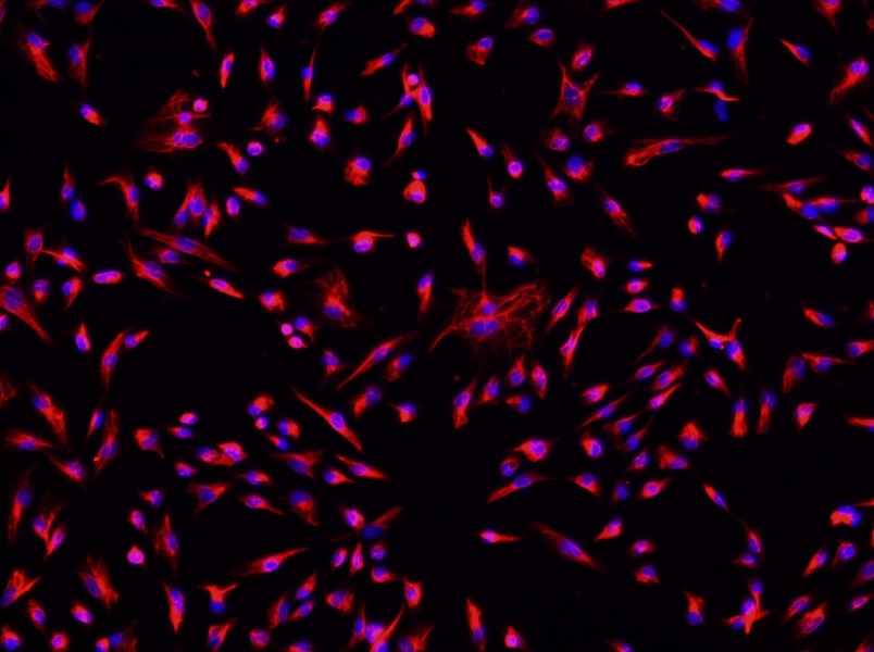 Rat Cardiac Fibroblast Complete Medium - small - 3